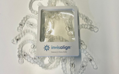 Waarom Invisalign een populair alternatief is voor een traditionele beugel